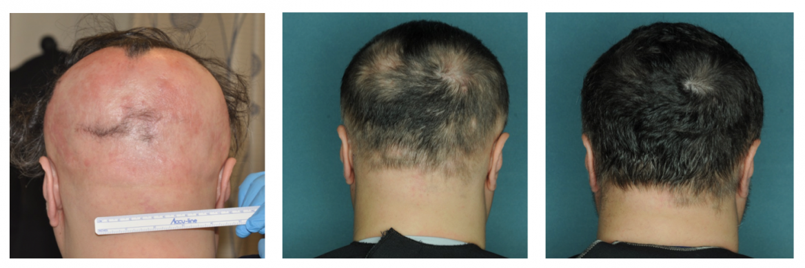 AA patient images